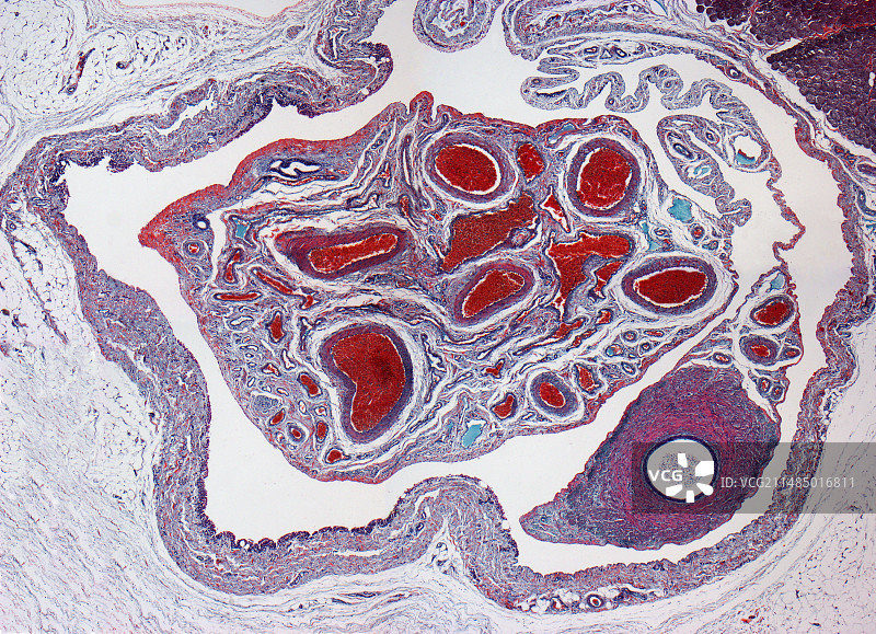 精索，光学显微照片图片素材