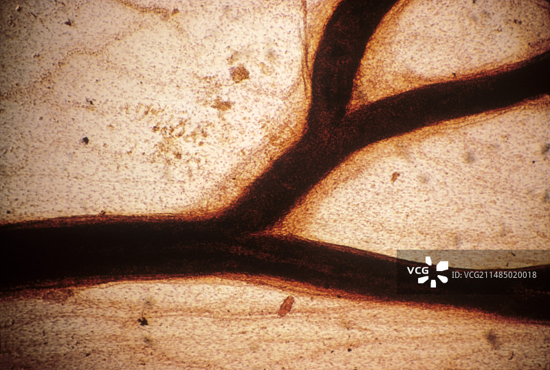 小动脉，光学显微照片图片素材