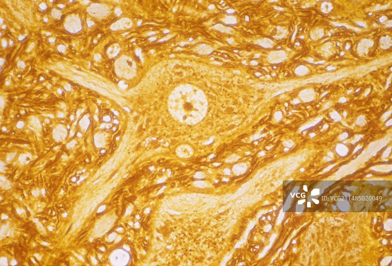 运动神经元（光学显微照片）图片素材