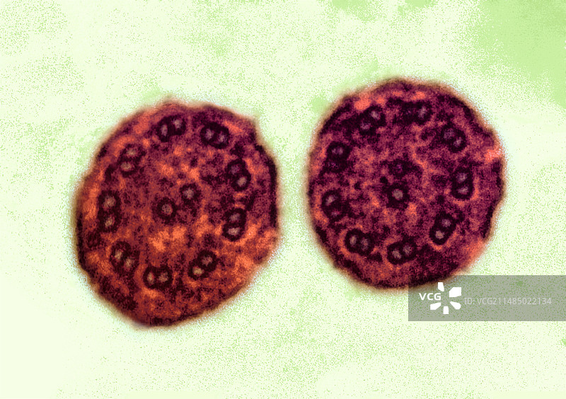 呼吸道纤毛显微照片图片素材