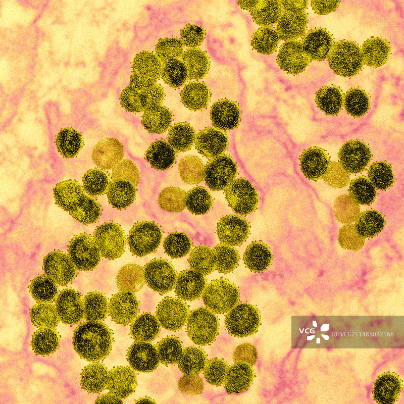 中东呼吸综合征冠状病毒颗粒TEM图片素材