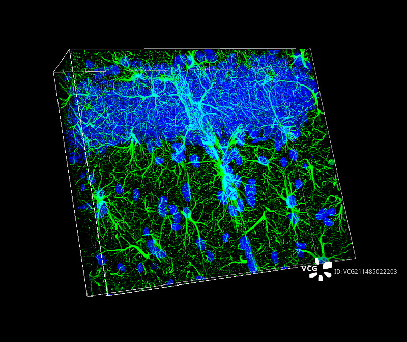 脑细胞荧光显微照片图片素材