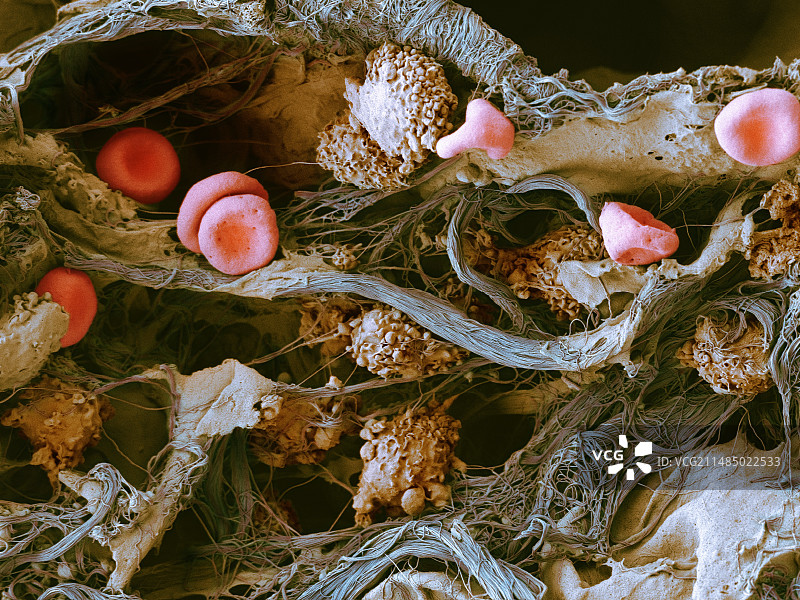 肺组织细胞,扫描电镜图片素材