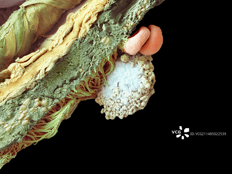 肺组织细胞,扫描电镜图片素材