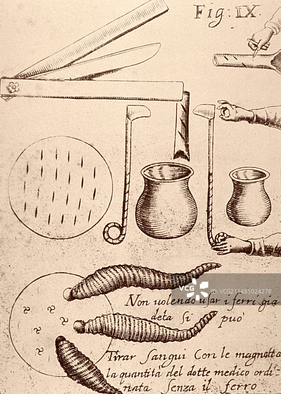 17世纪的放血器械图片素材