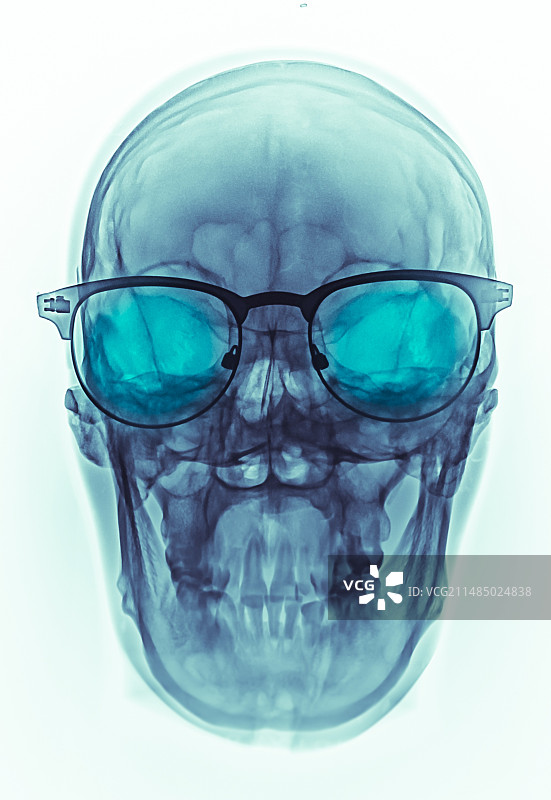 戴眼镜头骨X光片图片素材
