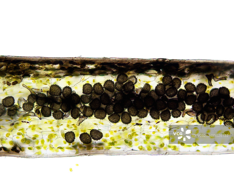 角苔孢子细胞显微照片图片素材