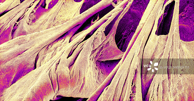 心脏瓣膜和腱索，扫描电子显微镜图图片素材