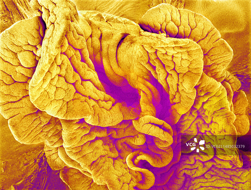 输卵管伞，扫描电镜图片素材