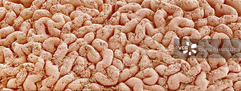 肠道内壁扫描电镜图图片素材