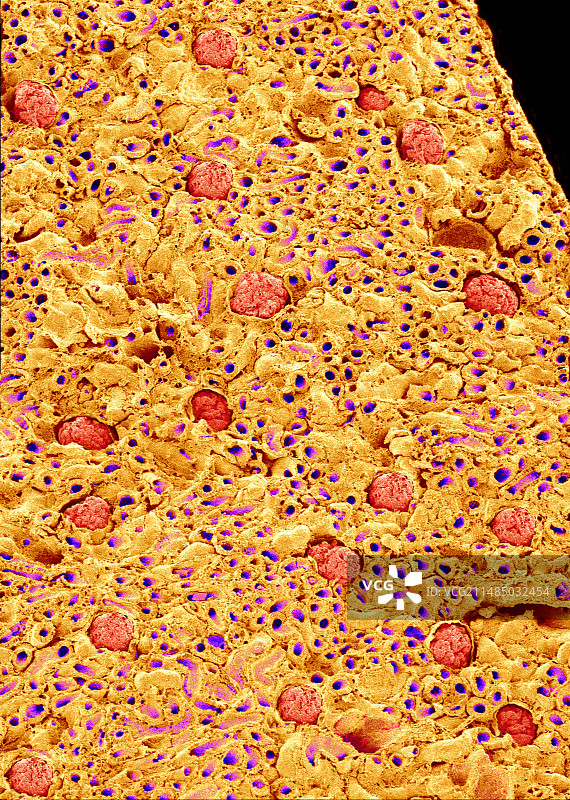 肾小球扫描电镜图图片素材