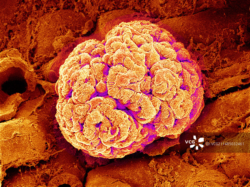 肾小球扫描电镜图图片素材