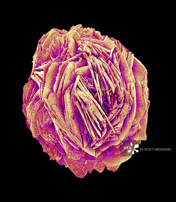 肾结石，扫描电镜图片素材