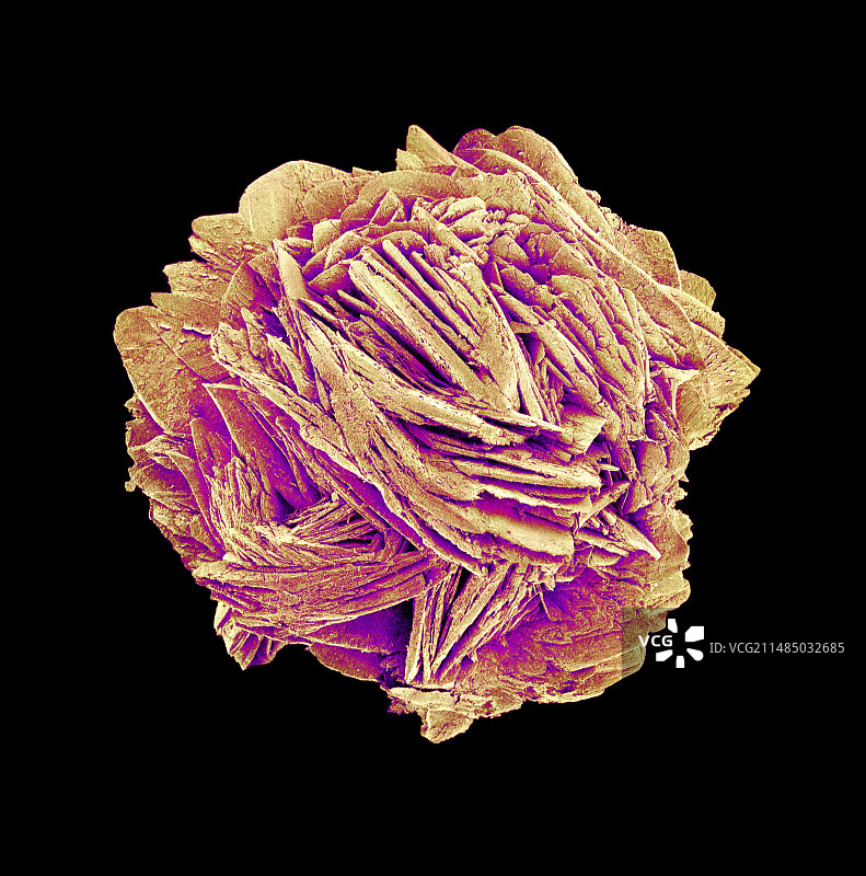 肾结石，扫描电镜图片素材