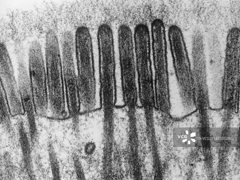 小肠内壁透射电镜图图片素材