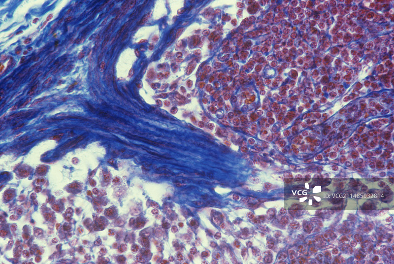 淋巴结显微照片图片素材