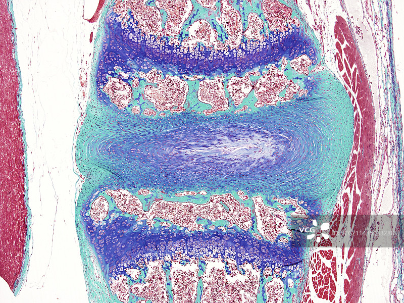 椎间盘，光学显微照片图片素材