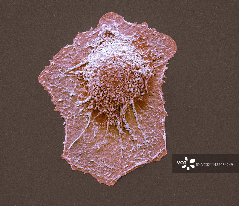 肺癌细胞扫描电镜图图片素材