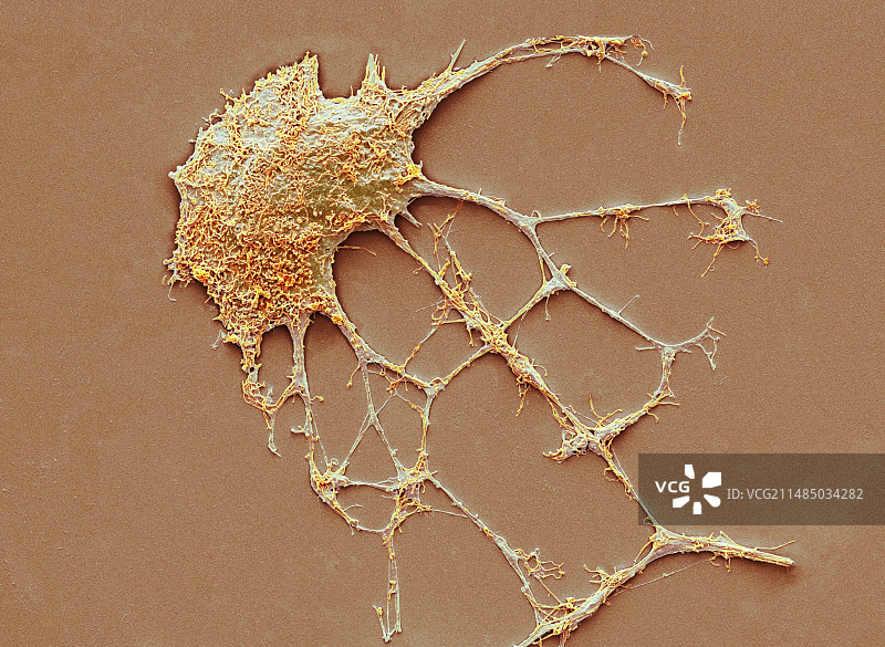 神经元扫描电镜图图片素材