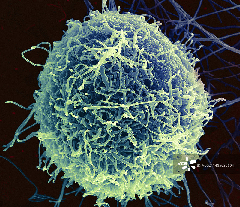 Ebola病毒细胞出芽，SEM图片素材