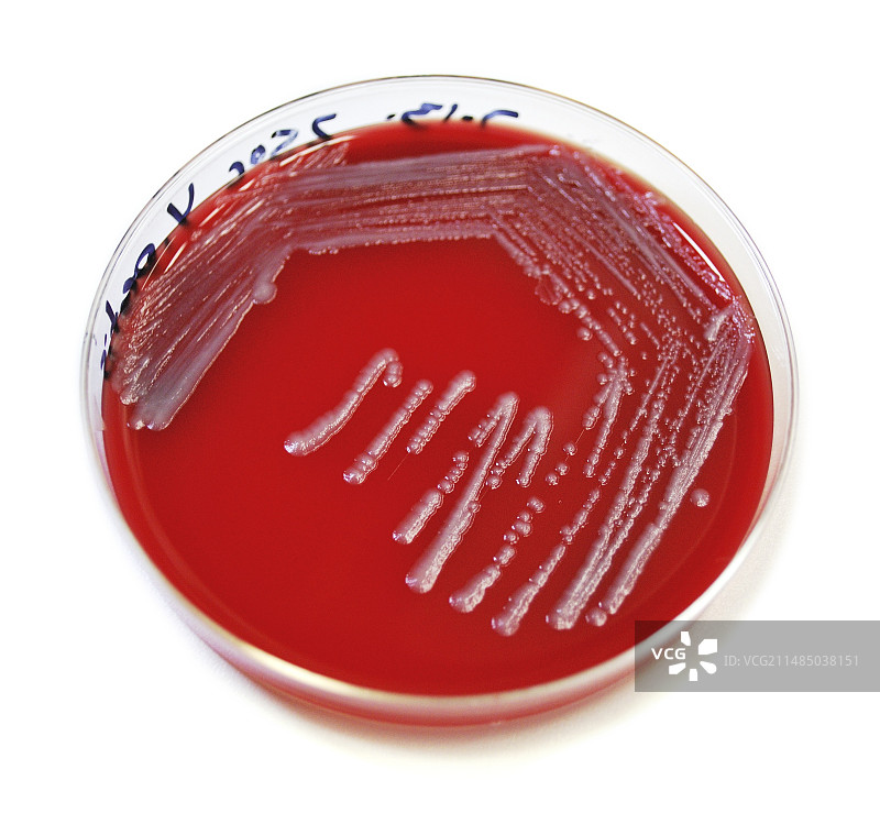 人类鼠疫细菌培养图片素材