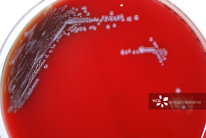 人类鼠疫细菌培养图片素材