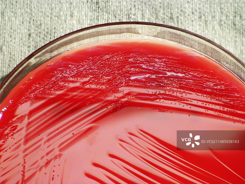 荧光假单胞菌细菌培养图片素材