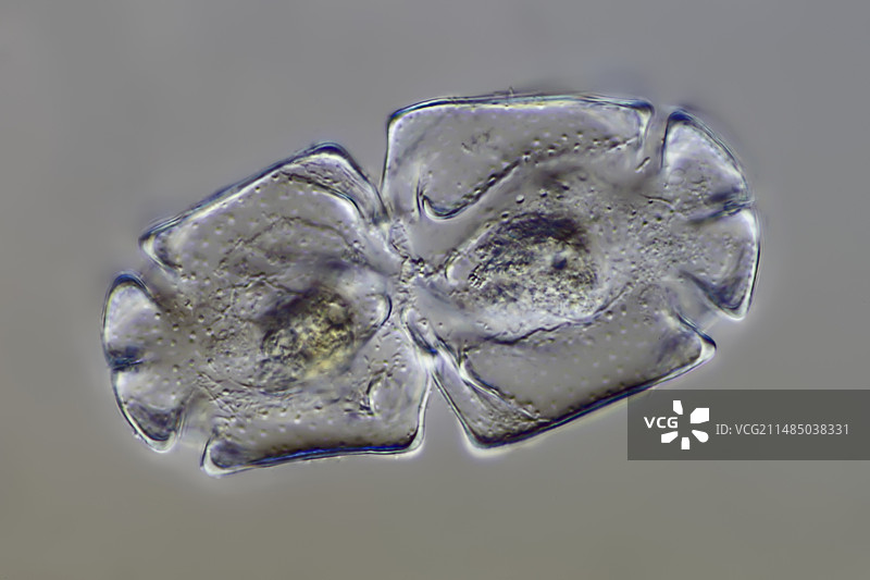 颗粒藻类显微照片图片素材