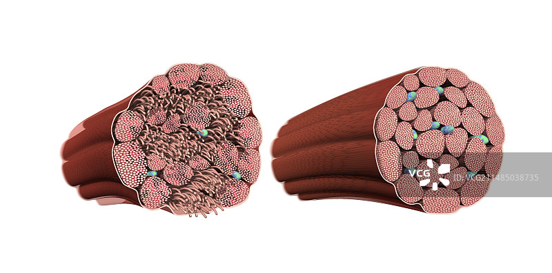 受损和完整的肌肉纤维，艺术作品图片素材