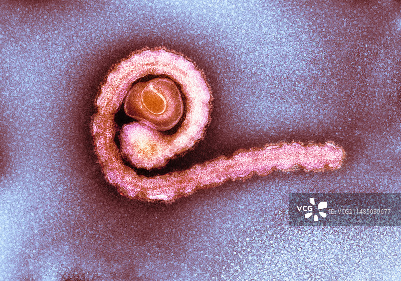 埃博拉病毒颗粒TEM图图片素材