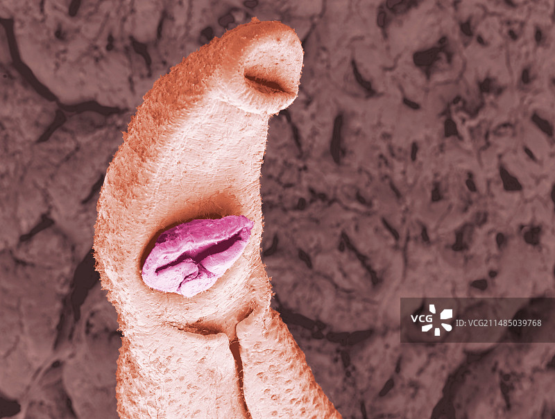 血吸虫扁虫（环境扫描电镜）图片素材