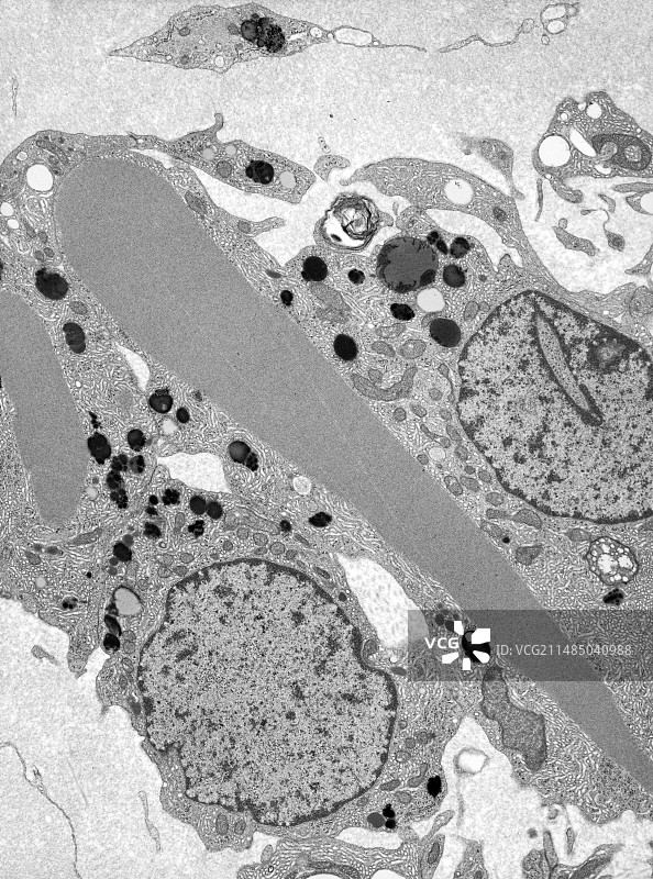 睾丸中的莱迪格细胞，TEM图片素材