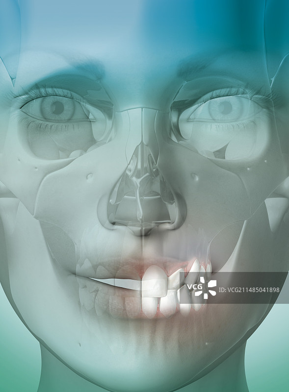 牙科反颌艺术图图片素材