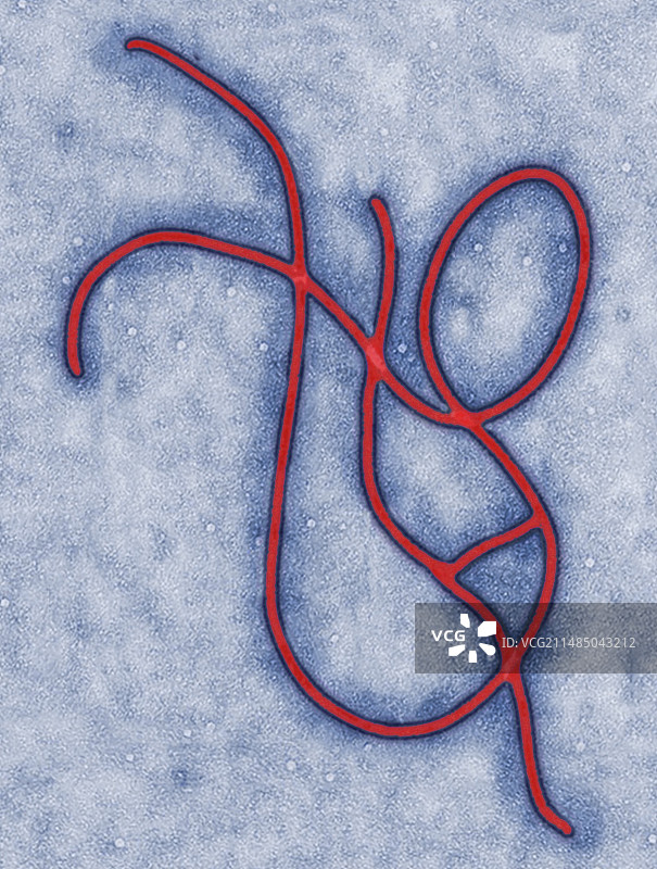 埃博拉病毒艺术作品图片素材