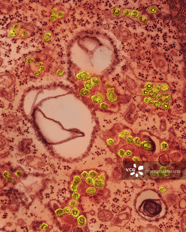 RNA肿瘤病毒，TEM图片素材