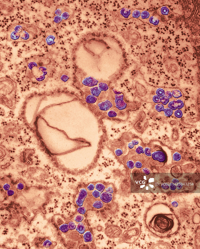 RNA肿瘤病毒，TEM图片素材