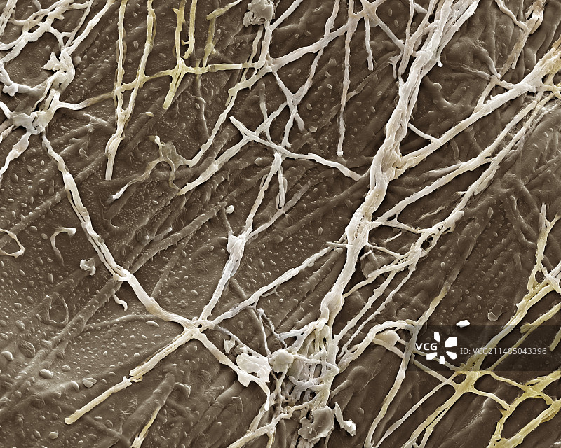 脚癣真菌，扫描电子显微镜图片素材