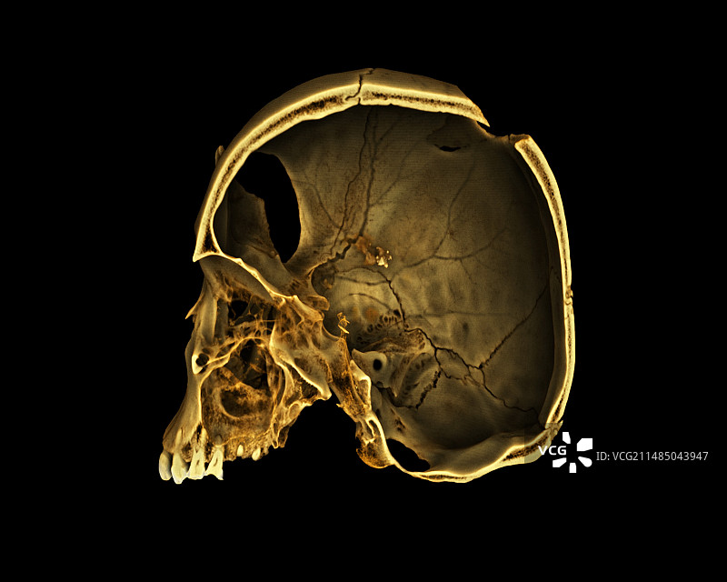 努比亚人头骨微CT扫描图片素材