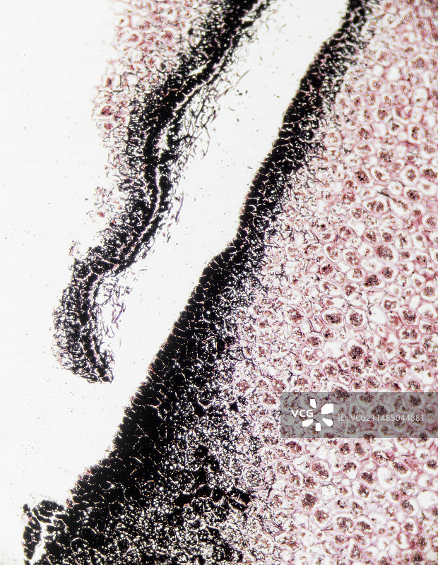 黄曲霉毒素真菌植物感染图片素材