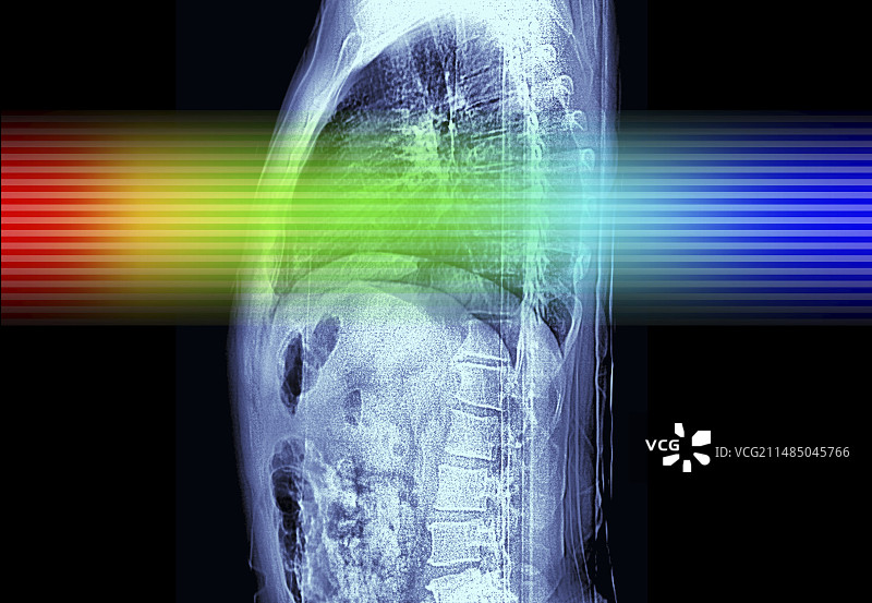 人体躯干MRI扫描图片素材