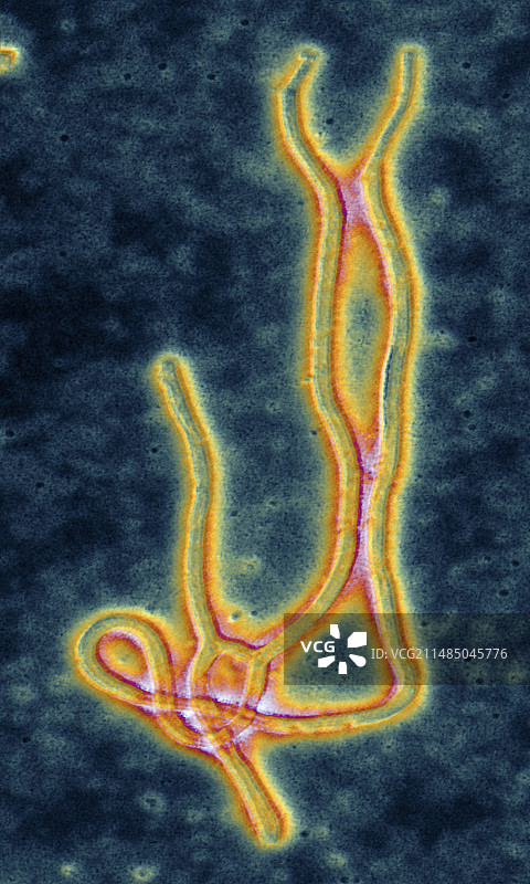 埃博拉病毒的彩色透射电镜图图片素材