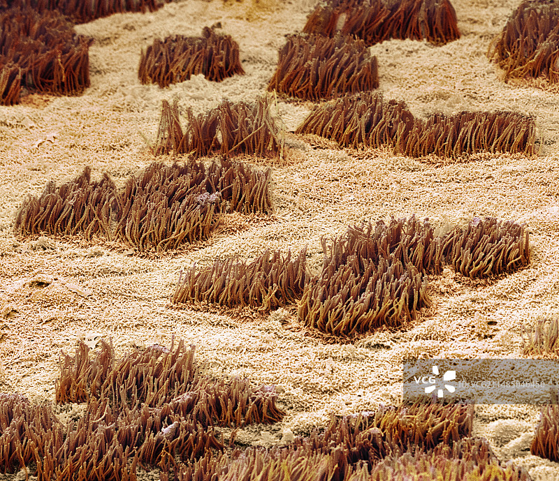 子宫扫描电镜图图片素材