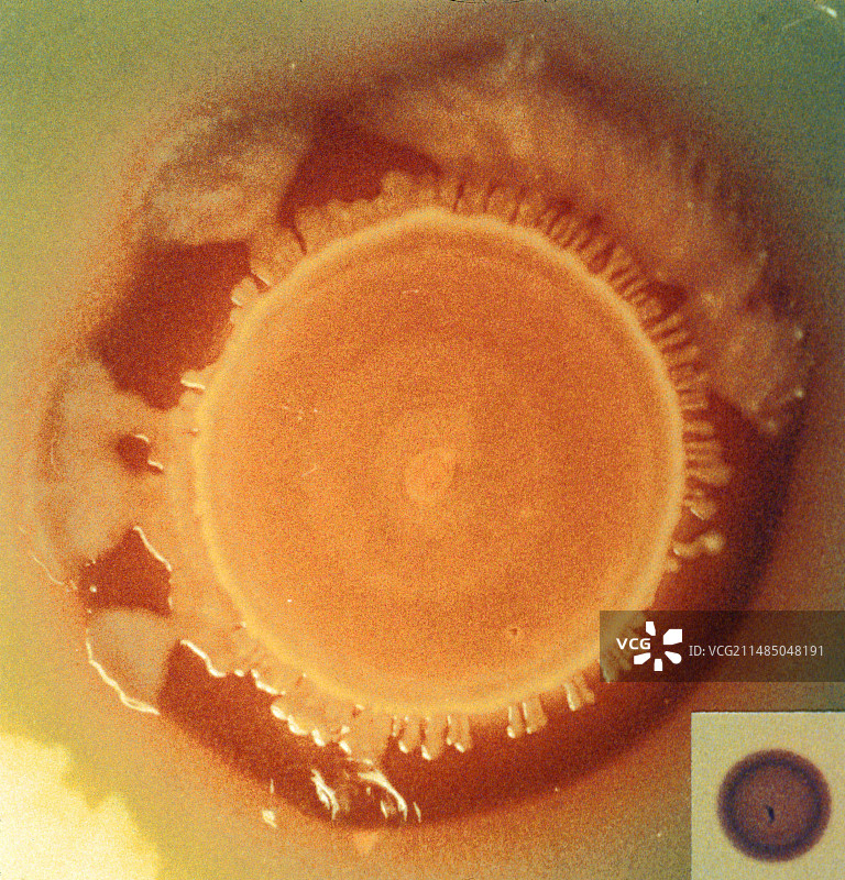 鼠伤寒沙门氏菌细菌培养图片素材