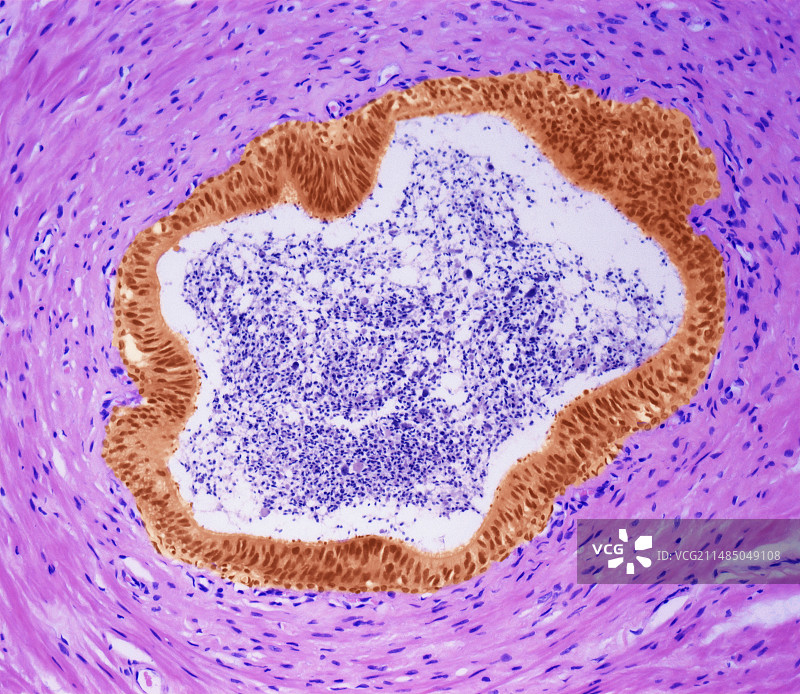 输精管显微照片图片素材