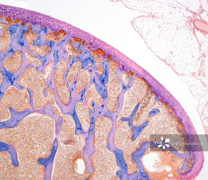 膝关节显微照片图片素材