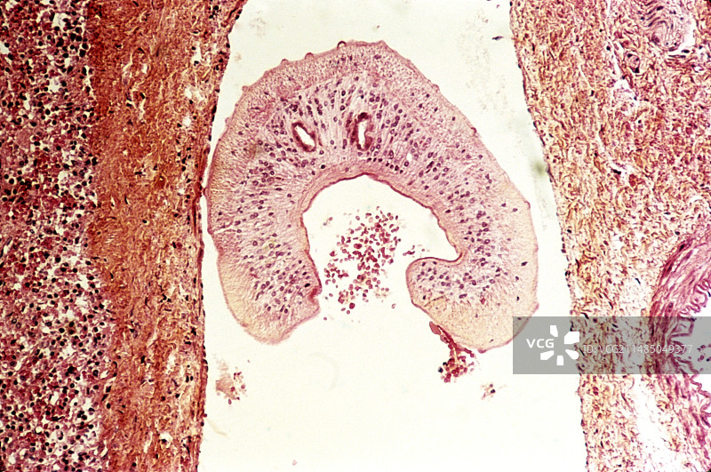 血吸虫寄生虫，光学显微照片图片素材