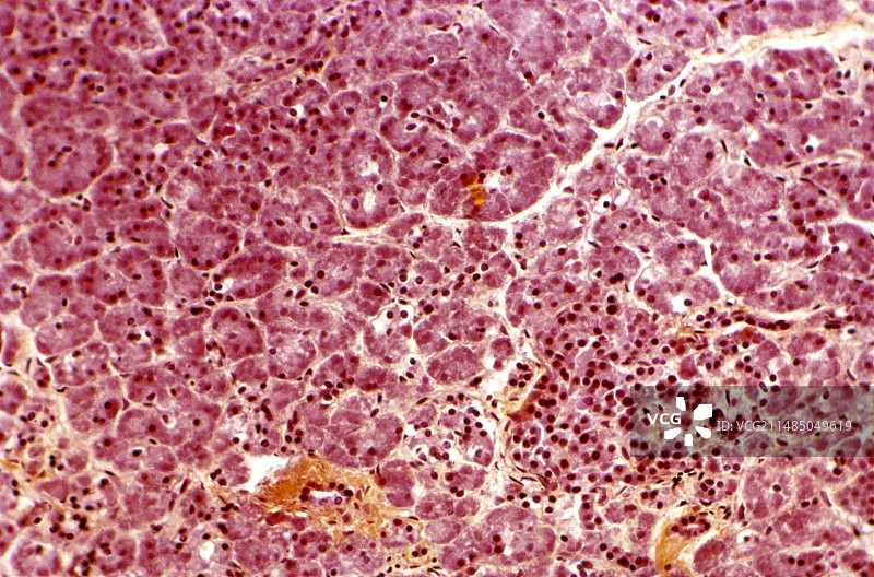 胰腺光学显微照片图片素材