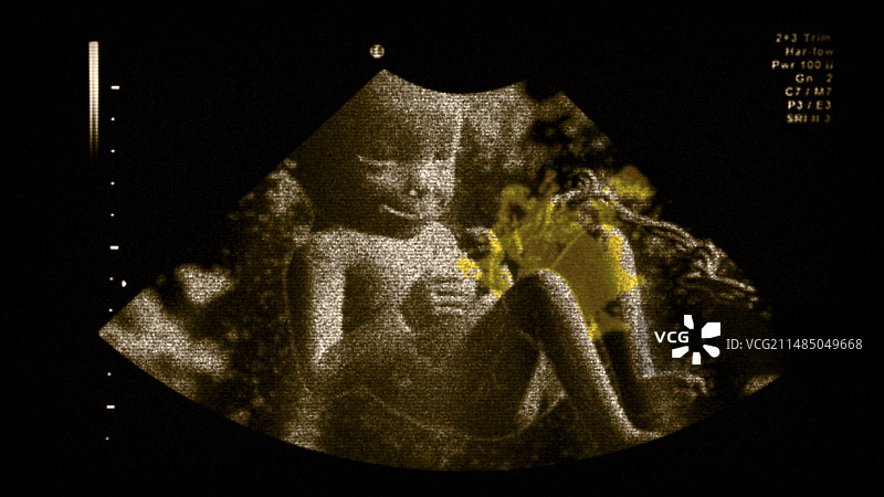 子宫内的胎儿图片素材