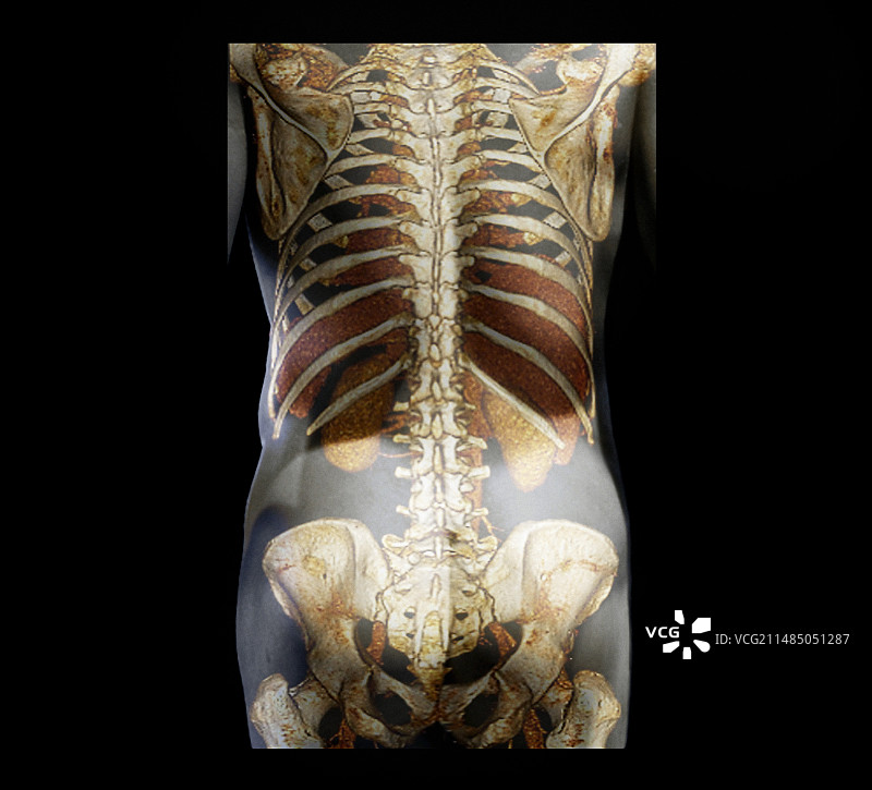 健康的脊柱3D CT扫描图片素材