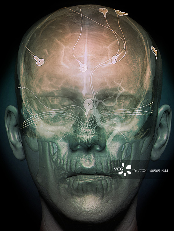 脑电图，3D CT扫描图片素材